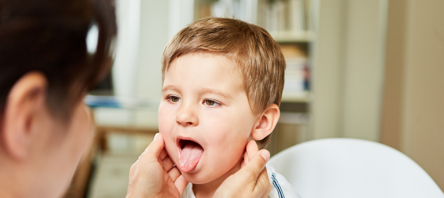 Understanding the Causes of Canker Sores and Effective Prevention & Healing Strategies